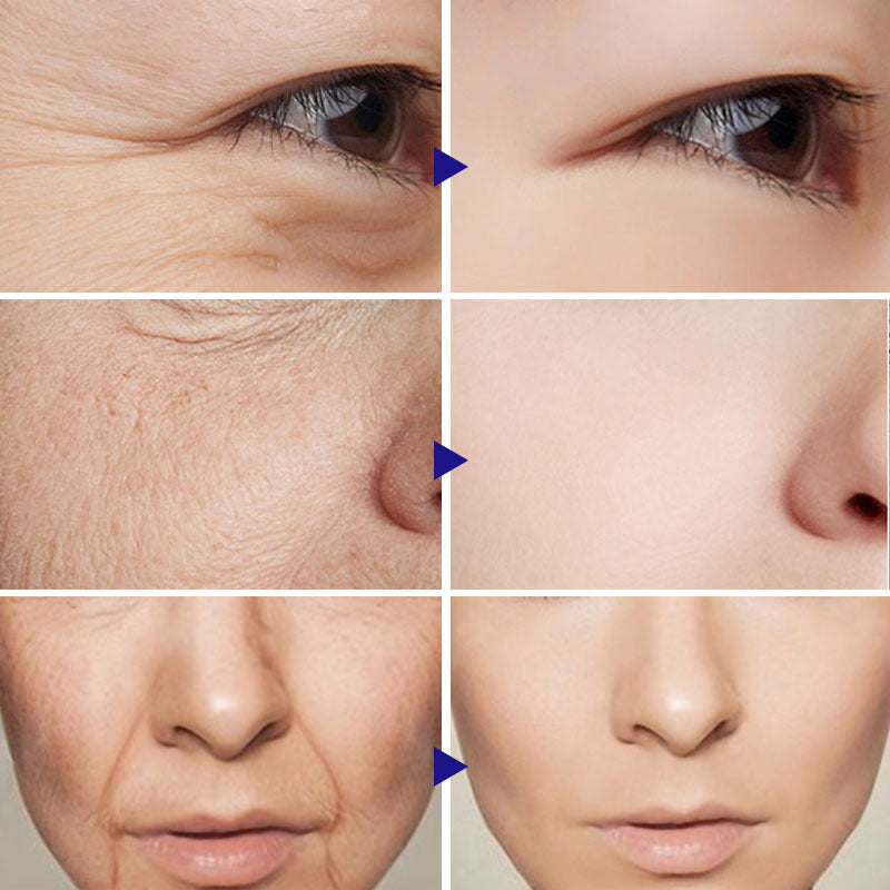 Vitamin C Serum Facial Serum for All Skin Type